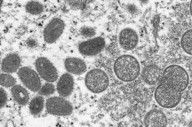 Illustration du virus de la variole du singe 