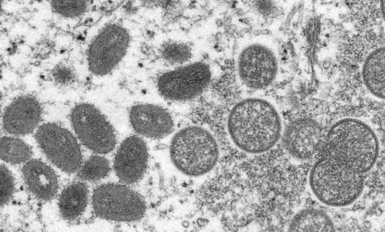 La variole du singe affecte-t-elle le plus les homosexuels