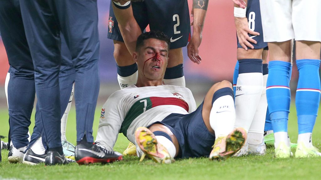 Cristiano Ronaldo le nez ensanglanté face à la République Tchèque pour la Ligue des Nations 