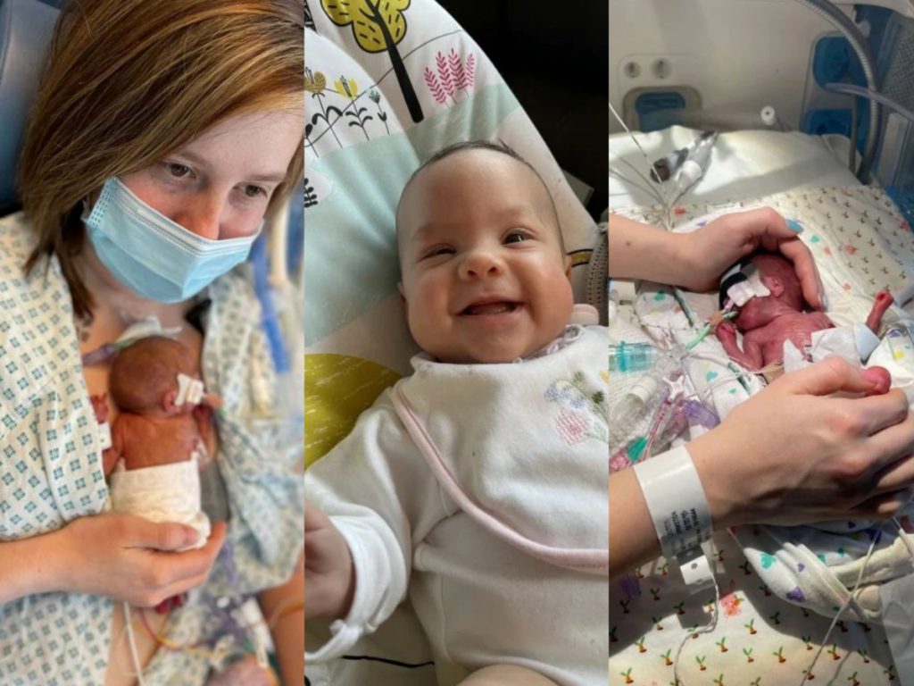 Bébé Isla est né le 4 mars 2022 alors que sa mère était à 23 semaines de grossesse. Elle a passé cinq mois à l'hôpital.