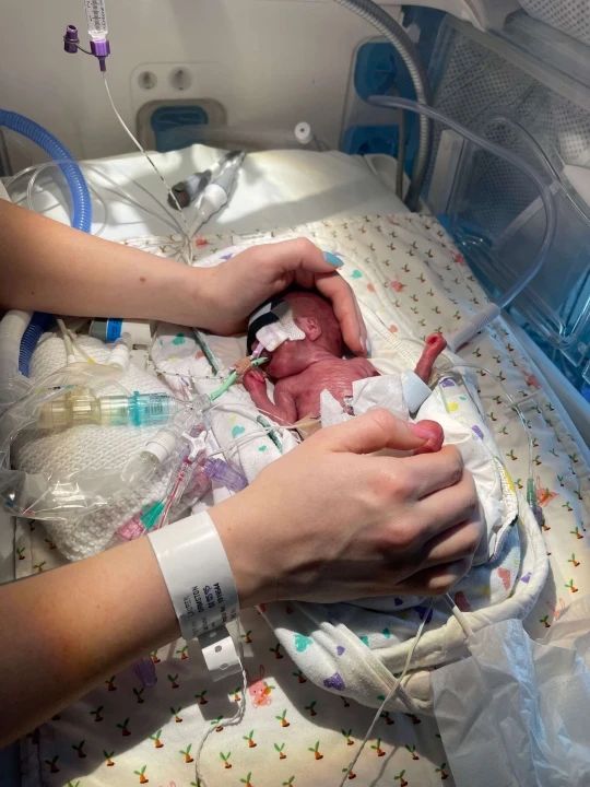 Bébé Isla est né le 4 mars 2022 alors que sa mère était à 23 semaines de grossesse. Elle a passé cinq mois à l'hôpital.