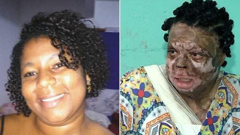 Une journaliste brûlée vive par son ex-mari jaloux