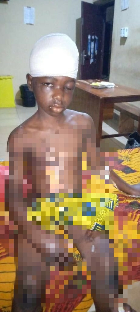 Dans l'État d'Enugu au Nigeria, un couple a été arrêté puis condamné à 13 de prison pour avoir employé et maltraité une fille de 10 ans