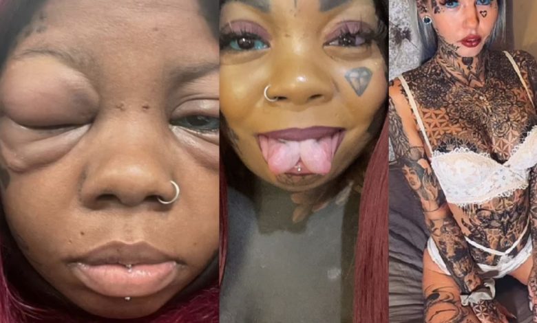 Voulant copier Amber Luke, Anaya Peterson, mère de cinq enfants se fait tatouer les globes oculaires et risque de devenir aveugle.